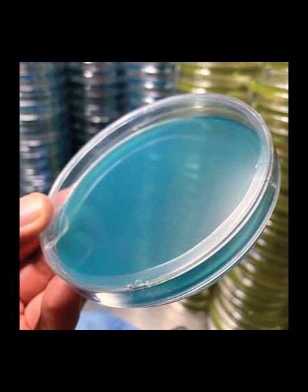 Agar Plates